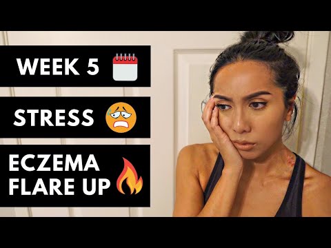 WEEK 5 – STRESS & ECZEMA (KETO FITNESS COMPETITION)