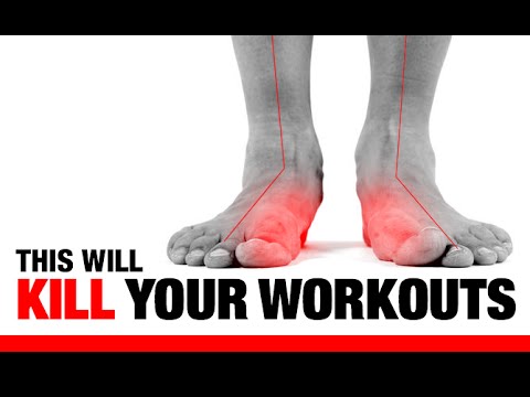 5 Ways Flat Feet “F” Up Your Workouts!! (EXERCISES TO FIX THEM!)