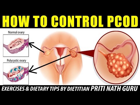 HOW TO CONTROL PCOD PROBLEM – EXERCISES & DIETARY TIPS  BY DIETITIAN PRITI NATH GURU II