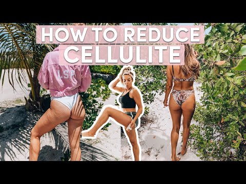 6 Ways I Reduced My CELLULITE | Tips, Food, Exercises & What Actually Works!